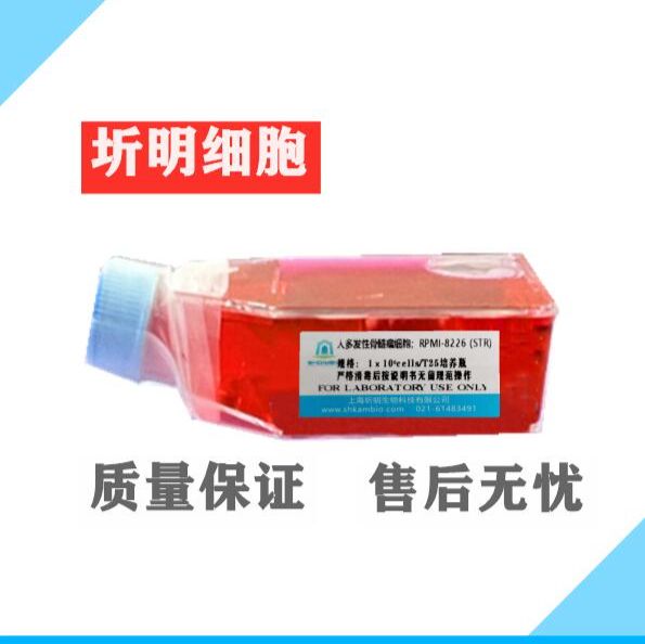 人肝癌细胞带绿色荧光;(圻明细胞库ATCC引种代购)