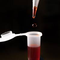 血红素结合蛋白（LEL/人源/鼠源）