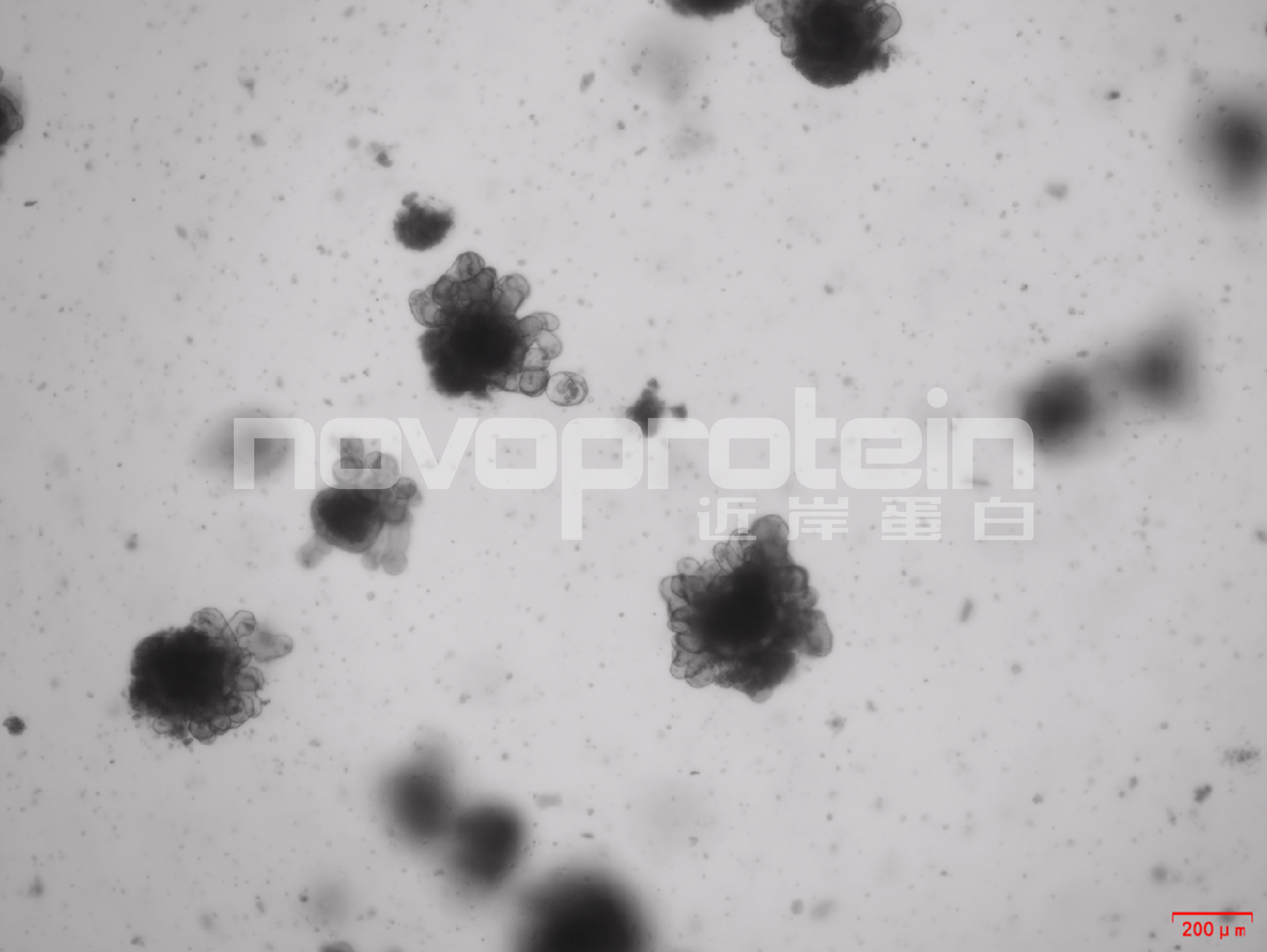 Recombinant Mouse Noggin (C-6H