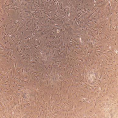 人急性淋巴细胞白血病细胞CEMC1/RFP (带红色荧光)