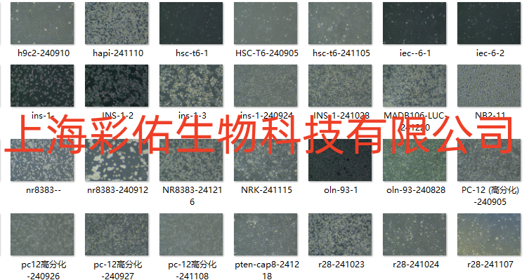 人急性淋巴细胞白血病细胞CEMC1/RFP (带红色荧光)