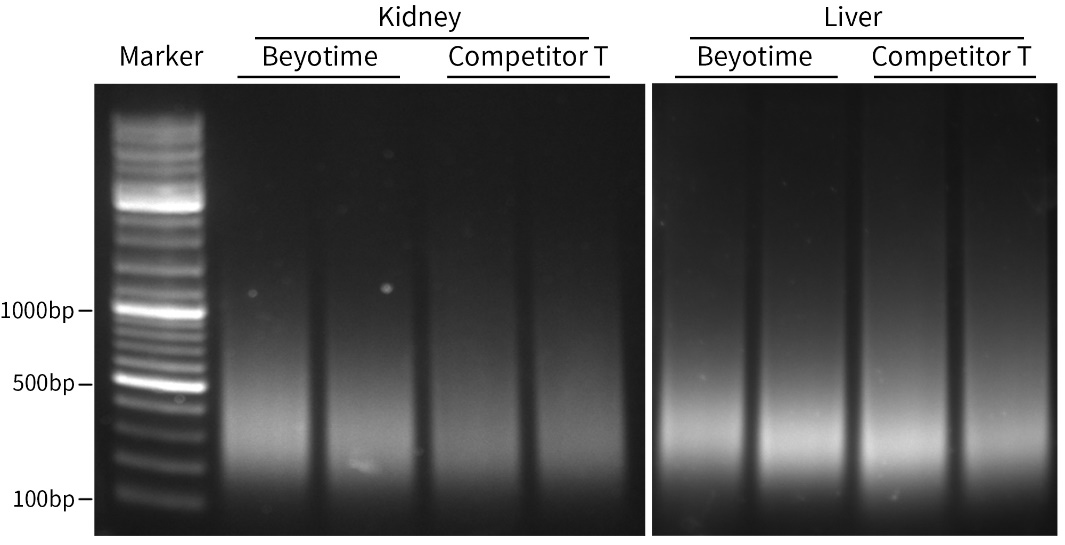 石蜡包埋组织基因组DNA抽提试剂盒(离心柱式)