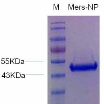 中东呼吸综合征病毒重组核衣壳蛋白