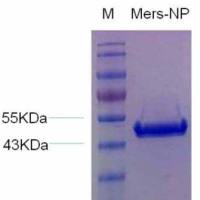 中东呼吸综合征病毒重组核衣壳蛋白