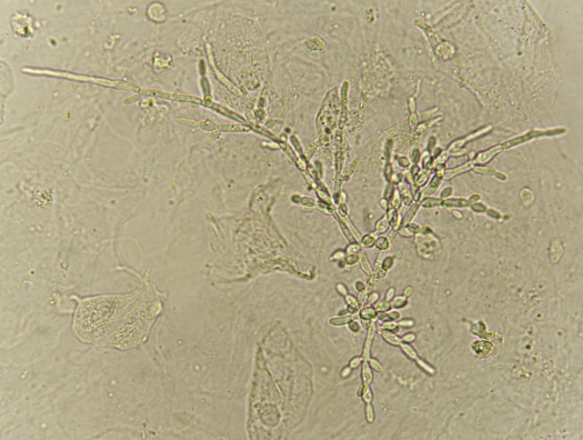 植物细胞组织培养技术探索