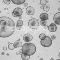 Recombinant Mouse Noggin (C-6His)