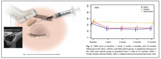 STEMCELL CryoStor® CS10 的应用案例