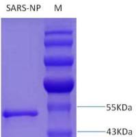 非典病毒重组核衣壳蛋白