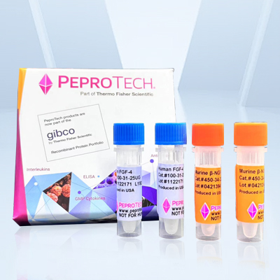 Biotinylated Rabbit Anti-Human VCAM-1 (1mg)