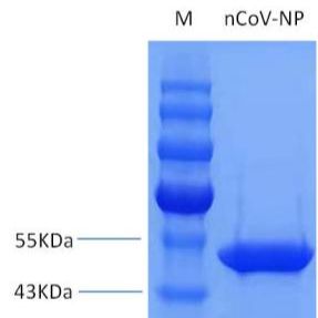 新 冠病毒重组核衣壳蛋白