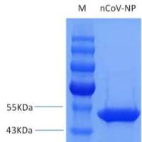 新 冠病毒重组核衣壳蛋白