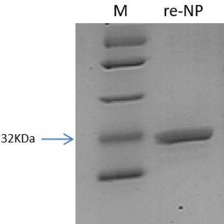SFTS 病毒重组核衣壳蛋白
