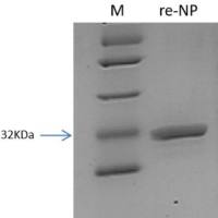 SFTS 病毒重组核衣壳蛋白