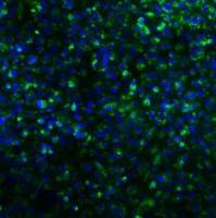 SFTS 病毒糖蛋白Gn单抗