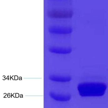 立夫特裂谷热 病毒NP重组蛋白