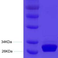 立夫特裂谷热 病毒NP重组蛋白