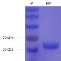 克里米亚-刚果出血热病毒NP重组蛋白