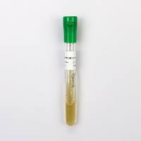 大肠埃希氏菌CMCC(B)44102（二代斜面）