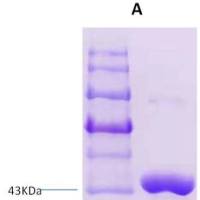 恙虫病重组诊断蛋白