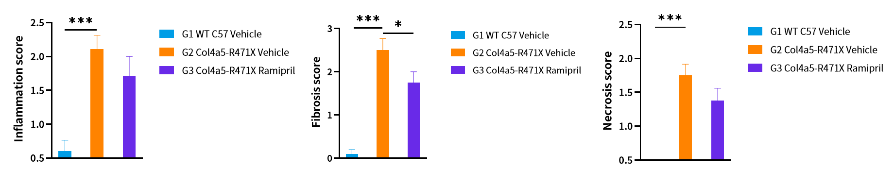 慢性肾病中的隐匿杀手——Alport综合征