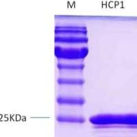 类鼻疽杆菌HCP1重组蛋白