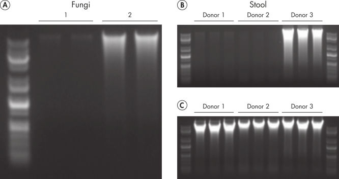 The new QIAamp PowerFecal Pro DNA Kit enables the isolation of larger amounts of high-quality DNA.