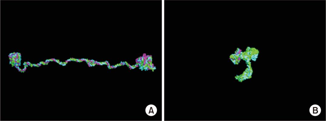 慢性肾病中的隐匿杀手——Alport综合征