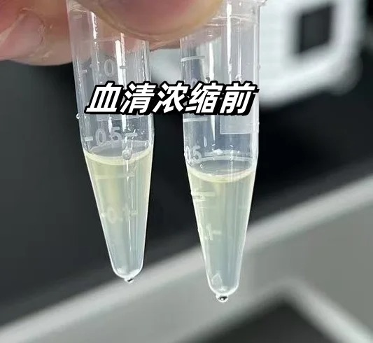 血清浓缩实验操作指南：真空离心浓缩仪的使用