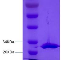 金黄色 葡萄球菌肠毒素B