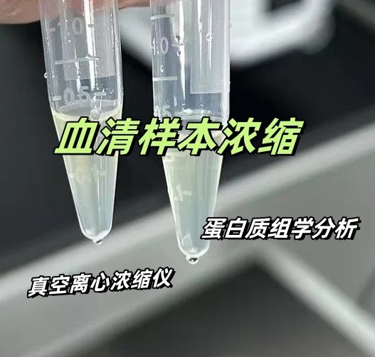 血清浓缩实验操作指南：真空离心浓缩仪的使用
