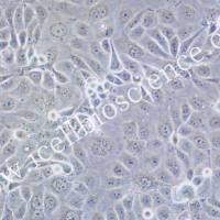 SNU-216细胞 | SNU216细胞 | SNU-216 | SNU216 | 人