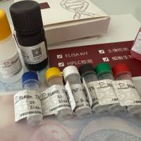 人（Human）衰老相关分泌表型（SASP）ELISA检测试剂盒