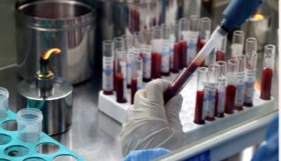 BIOCHANNEL 动物抗凝全血新品类上线啦