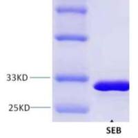 金黄色 葡萄球菌肠毒素B重组蛋白