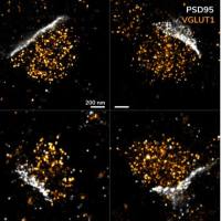MASSIVE-SDAB-FAST ANTI-VGLUT1 神经成像试剂盒
