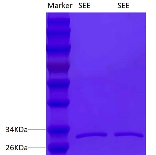 金黄色 葡萄球菌肠毒素E