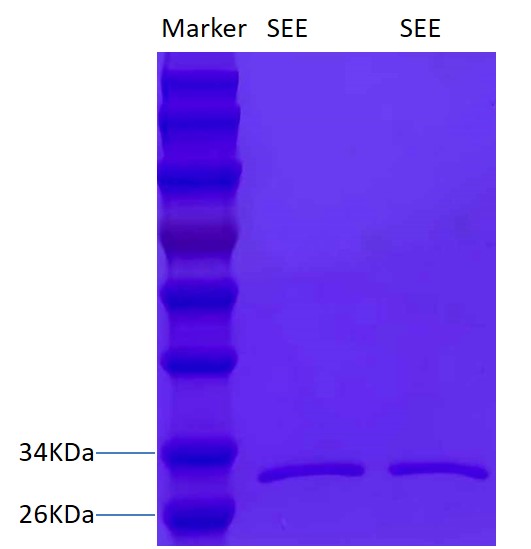 金黄色 葡萄球菌肠毒素E