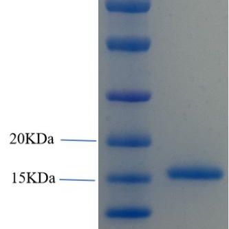 粉尘螨II型过敏原(Derf2)重组蛋白