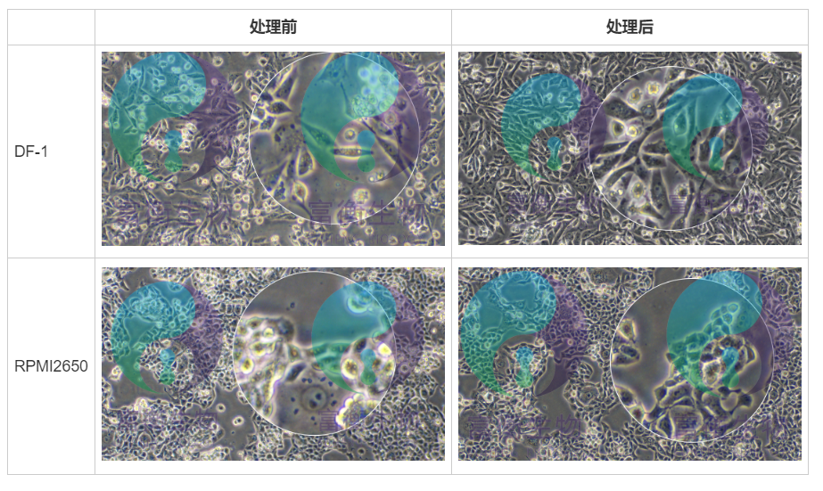 人非小细胞肺癌细胞；NCI-H358(STR)