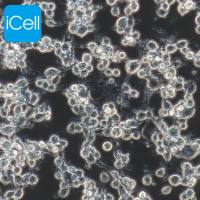 MFC 小鼠前胃癌细胞 ATCC细胞株、细胞系