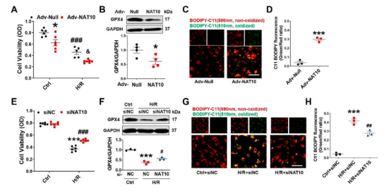 治疗心肌缺血再灌注新策略——哈尔滨医科大学团队揭示NAT10调控心肌缺血再灌注的分子机制