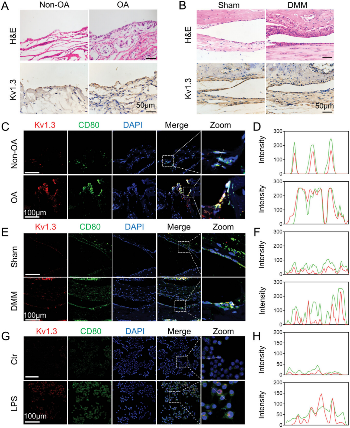 Adv Sci丨钾通道Kv1.3—OA 的潜在治疗靶点