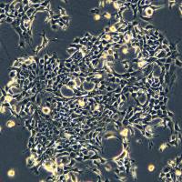 4T1细胞敲除mUSP22基因细胞系