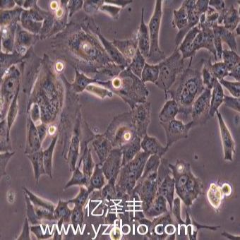 glioma261小鼠神经胶质瘤细胞