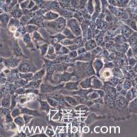 BT-474人乳腺导管癌细胞