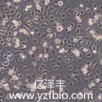 TE-1人食管癌细胞