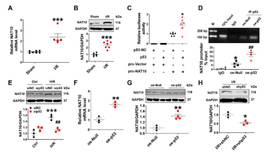 治疗心肌缺血再灌注新策略——哈尔滨医科大学团队揭示NAT10调控心肌缺血再灌注的分子机制