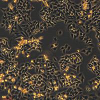 Hela细胞敲除hZKSCAN3基因细胞系