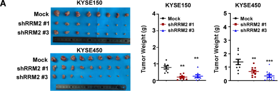 郑州大学团队发现联苯苄唑通过靶向HuR/RRM2轴抑制ESCC增殖的分子机制