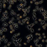 293T细胞敲除hSMPD1基因细胞系